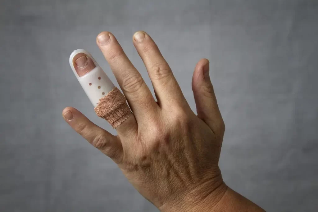 Finger-splint