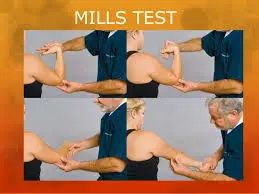 Mill test