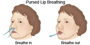 Pursed lip breathing