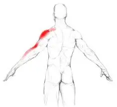 Supraspinatus Muscle Pain