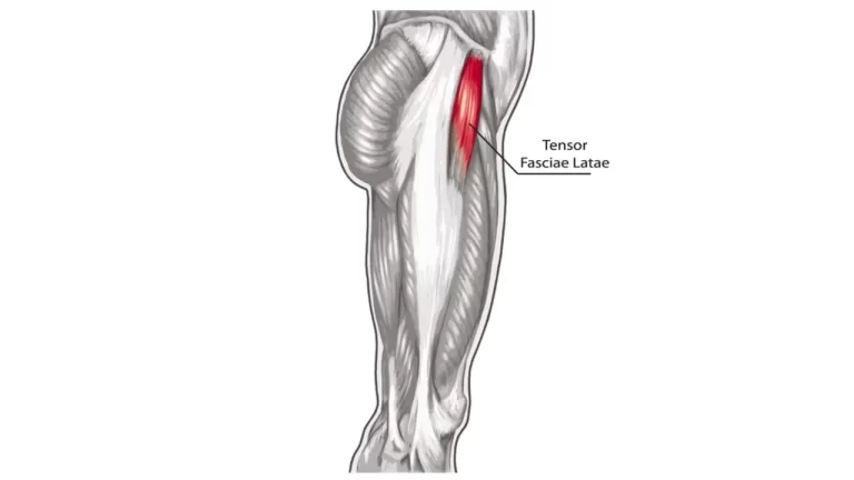 Tensor Fascia Latae Muscle Pain