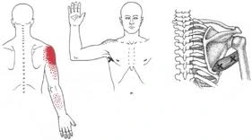 Teres Major Muscle Pain