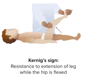 kernig sign