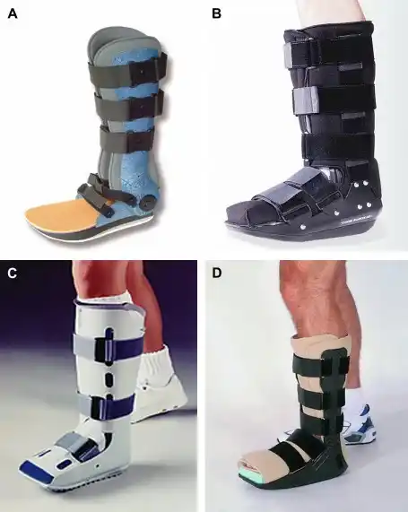 Orthotic Treatment of Charcot Feet