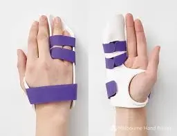 Splinting-for-Dupuytren_s-Contracture