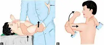 The anterior drawer test