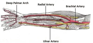Read more about the article Ulnar Artery Thrombosis