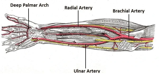 Ulnar artery thrombosis