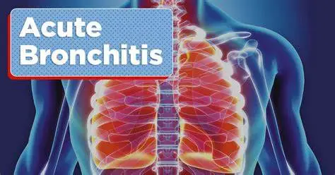 Acute bronchitis