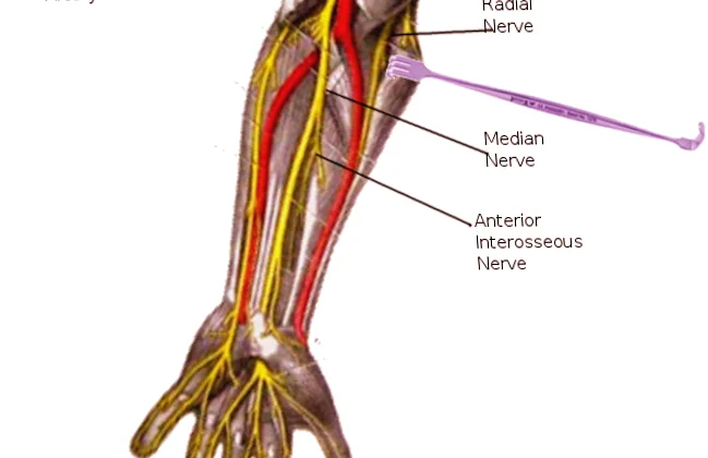 Anterior Interosseous Nerve