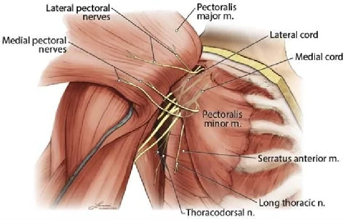 Medial Pectoral Nerve