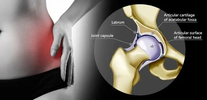 Can knee pain cause groin pain