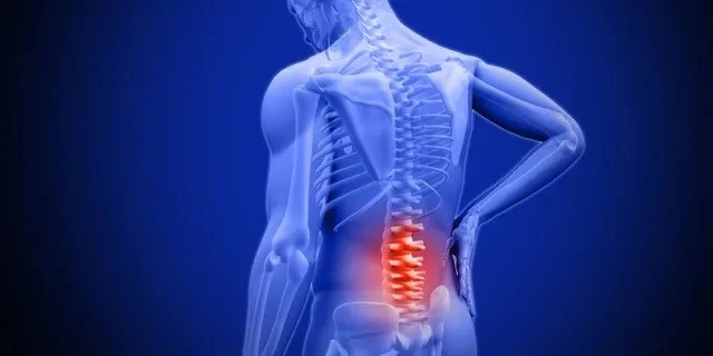 Lumbar Strain