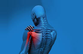 Neck and Shoulder Pain