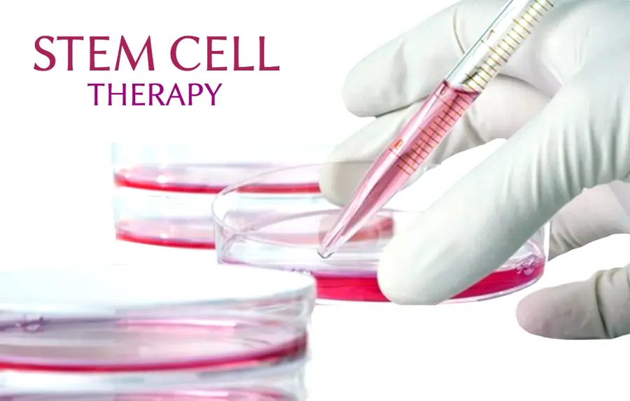 Stem Cell Therapy