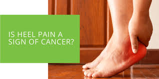 Heel Pain a Sign of Cancer