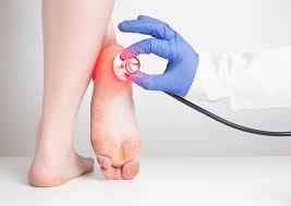 Heel Pain a Sign of Diabetes