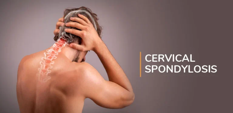 How to cure cervical spondylosis permanently