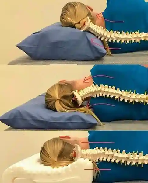 Shape-of-the-pillow