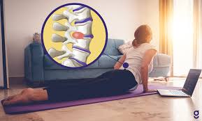 7 Exercises to Heal Slipped Disc Naturally