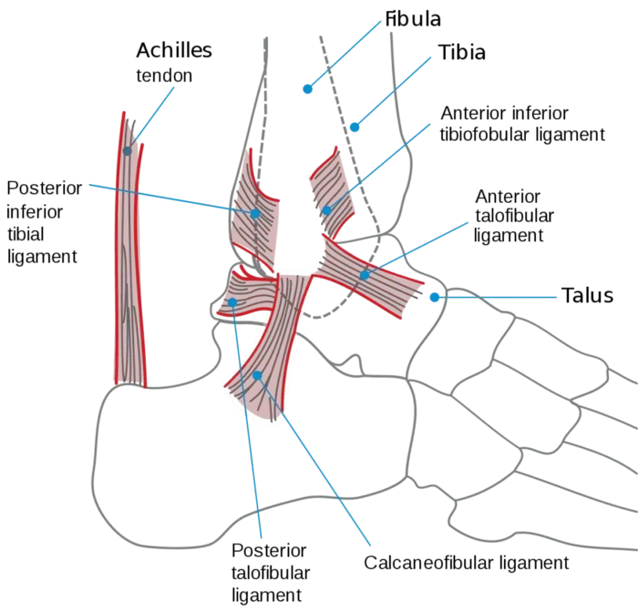Anterior Talofibular Ligament (ATFL) Tear