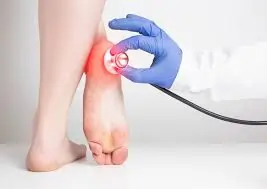 Heel Pain a Sign of Diabetes