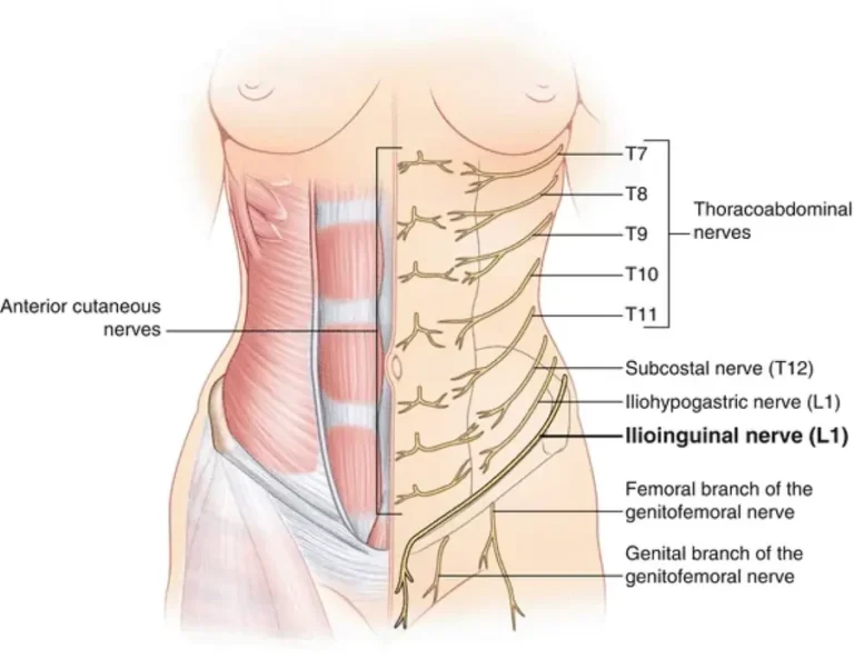 Iliohypogastric nerve