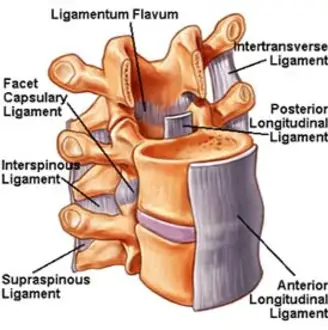 Posterior Longitudinal Ligament (PLL) Injury