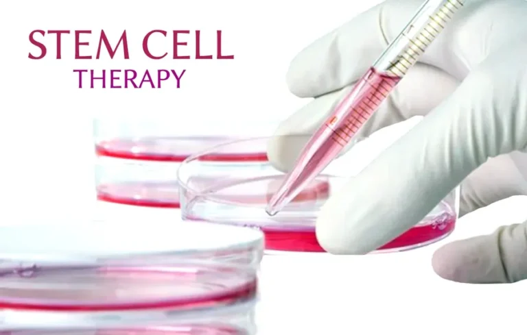 Stem Cell Therapy
