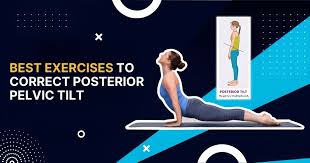 Correct Posterior Pelvic Tilt with These Top 5 Exercises