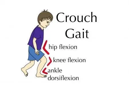 crouch-gait