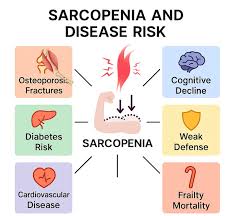 Sarcopenia