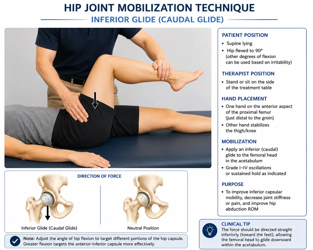 Hip joint mobilization technique: anterior glide