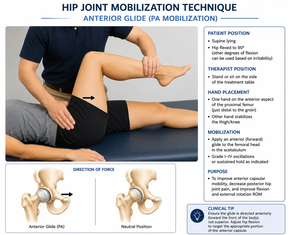 Hip joint mobilization technique: anterior glide