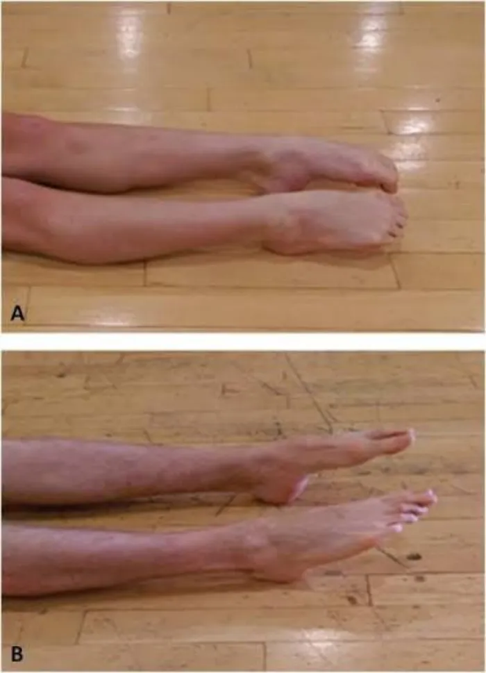 planterflexion